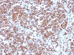Cyclin D1 Antibody (CCND1/3370R) - Azide and BSA Free, Novus Biologicals 100 &mu;g | Buy Online | Novus Biologicals | Fisher Scientific